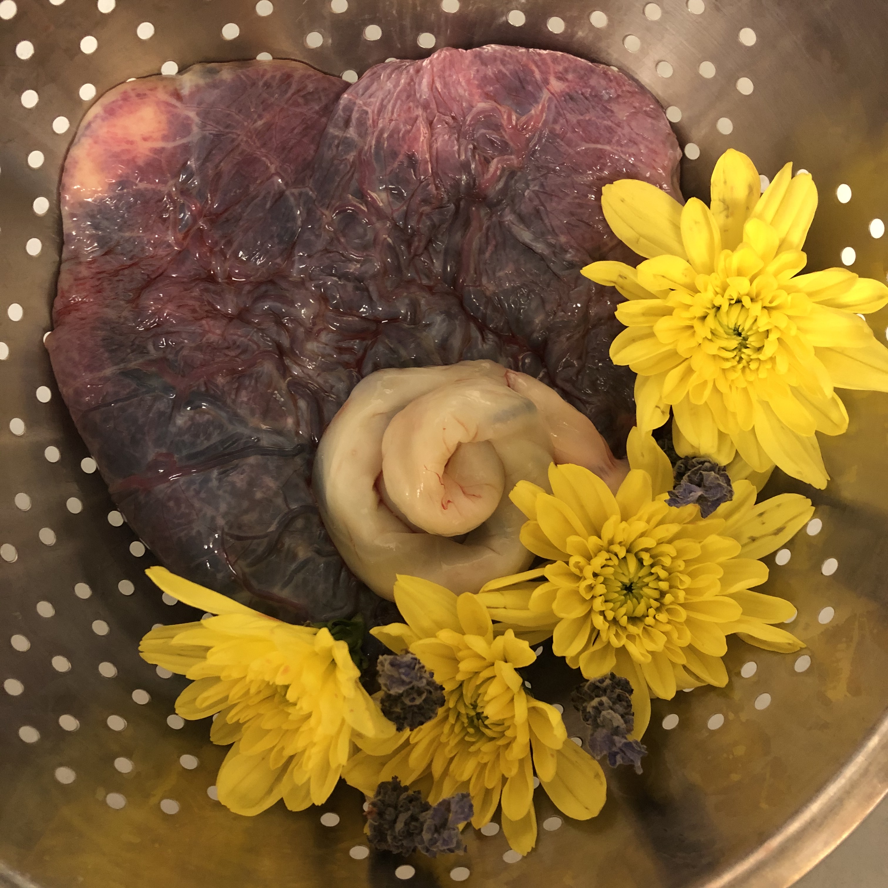 Placenta Processing – Goodland Doula